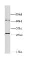 Calpain small subunit 1 antibody, FNab01250, FineTest, Western Blot image 