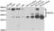 BCL2/adenovirus E1B 19 kDa protein-interacting protein 3-like antibody, LS-C334612, Lifespan Biosciences, Western Blot image 