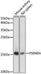 Presenilin Enhancer, Gamma-Secretase Subunit antibody, LS-C750142, Lifespan Biosciences, Western Blot image 