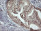 Musashi RNA Binding Protein 1 antibody, M05052-2, Boster Biological Technology, Immunohistochemistry paraffin image 