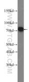 Moesin antibody, 16495-1-AP, Proteintech Group, Western Blot image 