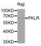 Pyruvate Kinase L/R antibody, LS-C346055, Lifespan Biosciences, Western Blot image 