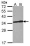 Tropomyosin 3 antibody, NBP2-20732, Novus Biologicals, Western Blot image 