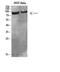 Interleukin 4 Receptor antibody, STJ97665, St John