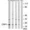 Cysteine and glycine-rich protein 1 antibody, PA5-49793, Invitrogen Antibodies, Western Blot image 