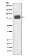 CD36 Molecule antibody, M01189, Boster Biological Technology, Western Blot image 