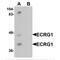 Transmembrane Serine Protease 11A antibody, MBS150872, MyBioSource, Western Blot image 