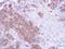 MAGUK p55 subfamily member 3 antibody, LS-C185500, Lifespan Biosciences, Immunohistochemistry paraffin image 
