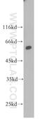 Prolyl 4-hydroxylase subunit alpha-1 antibody, 12658-1-AP, Proteintech Group, Western Blot image 