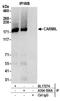 Capping Protein Regulator And Myosin 1 Linker 1 antibody, A304-556A, Bethyl Labs, Immunoprecipitation image 