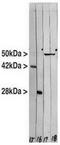 Vimentin antibody, TA336857, Origene, Western Blot image 