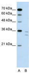 CD8b Molecule antibody, TA346386, Origene, Western Blot image 