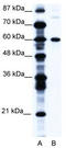 CCR4-NOT transcription complex subunit 3 antibody, TA335620, Origene, Western Blot image 