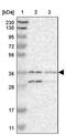 Cytochrome b-561 antibody, PA5-53228, Invitrogen Antibodies, Western Blot image 