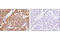 Cyclin Dependent Kinase 4 antibody, 12790T, Cell Signaling Technology, Immunohistochemistry paraffin image 