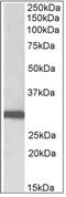 STOM antibody, AP32348PU-N, Origene, Western Blot image 