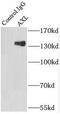 AXL Receptor Tyrosine Kinase antibody, FNab00754, FineTest, Immunoprecipitation image 