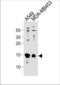 ADF antibody, TA325133, Origene, Western Blot image 