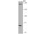 Leucine Rich Repeat Kinase 1 antibody, NBP2-75556, Novus Biologicals, Western Blot image 