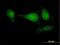 Adaptor Protein, Phosphotyrosine Interacting With PH Domain And Leucine Zipper 2 antibody, H00055198-B01P, Novus Biologicals, Immunocytochemistry image 
