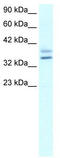 ETS Homologous Factor antibody, TA329428, Origene, Western Blot image 