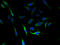Electroneutral sodium bicarbonate exchanger 1 antibody, A61014-100, Epigentek, Immunofluorescence image 