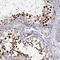 RBMX Like 2 antibody, NBP1-92000, Novus Biologicals, Immunohistochemistry paraffin image 