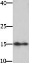 High Mobility Group AT-Hook 2 antibody, TA321583, Origene, Western Blot image 