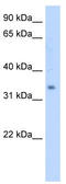 Methylsterol Monooxygenase 1 antibody, TA341859, Origene, Western Blot image 