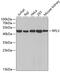 60S ribosomal protein L3 antibody, 19-273, ProSci, Western Blot image 