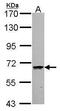 Coenzyme A Synthase antibody, GTX107623, GeneTex, Western Blot image 
