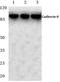 Cadherin 8 antibody, PA5-36347, Invitrogen Antibodies, Western Blot image 