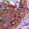 Neural Proliferation, Differentiation And Control 1 antibody, LS-C356221, Lifespan Biosciences, Immunohistochemistry paraffin image 