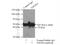 Tropomodulin 4 antibody, 11753-1-AP, Proteintech Group, Immunoprecipitation image 