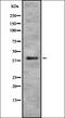 Proteasome Subunit Alpha 7 antibody, orb337154, Biorbyt, Western Blot image 
