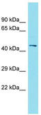 Family With Sequence Similarity 181 Member B antibody, TA335361, Origene, Western Blot image 