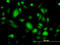 G Protein Subunit Beta 3 antibody, LS-C197318, Lifespan Biosciences, Immunofluorescence image 