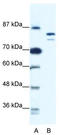DNA replication licensing factor MCM8 antibody, TA341697, Origene, Western Blot image 