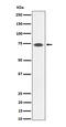 Somatostatin Receptor 3 antibody, M04188-1, Boster Biological Technology, Western Blot image 