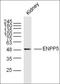 Ectonucleotide Pyrophosphatase/Phosphodiesterase Family Member 5 antibody, orb156737, Biorbyt, Western Blot image 