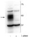 Myocyte-specific enhancer factor 2C antibody, P01131, Boster Biological Technology, Western Blot image 