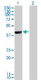 Calcium/Calmodulin Dependent Protein Kinase ID antibody, LS-B6353, Lifespan Biosciences, Western Blot image 