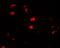 Ubiquitin Specific Peptidase 25 antibody, A06182, Boster Biological Technology, Immunofluorescence image 