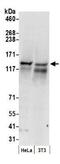 UPF1 RNA Helicase And ATPase antibody, GTX10510, GeneTex, Western Blot image 