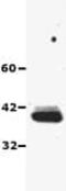 Stearoyl-CoA Desaturase antibody, ab19862, Abcam, Western Blot image 