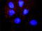 SLC9A3 Regulator 1 antibody, H00009368-M02, Novus Biologicals, Proximity Ligation Assay image 