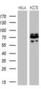 ROS Proto-Oncogene 1, Receptor Tyrosine Kinase antibody, MA5-26760, Invitrogen Antibodies, Western Blot image 