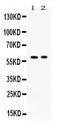 Autoimmune Regulator antibody, PB9980, Boster Biological Technology, Western Blot image 
