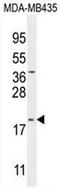 Chromosome 20 Open Reading Frame 173 antibody, AP51111PU-N, Origene, Western Blot image 