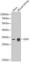 Gamma-Glutamyl Hydrolase antibody, GTX32628, GeneTex, Western Blot image 